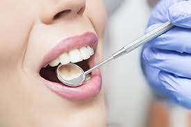 The Role Of General Dentists In Oral Cancer Screening
